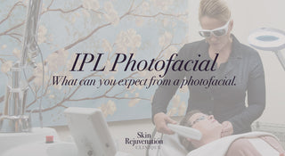 What can you expect from a IPL Photofacial?